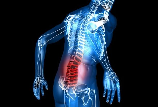 Osteochondrosis symptoms